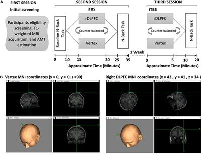 Enhancing Visuospatial Working Memory Performance Using Intermittent Theta-Burst Stimulation Over the Right Dorsolateral Prefrontal Cortex
